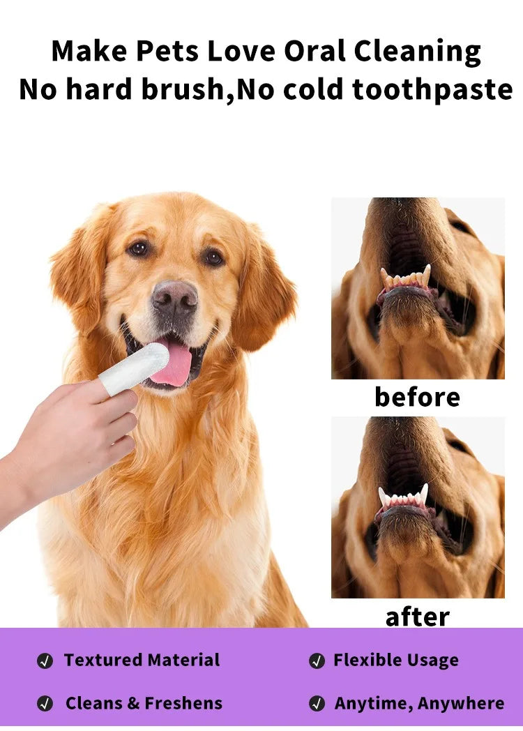 Teeth Cleaning Wipes